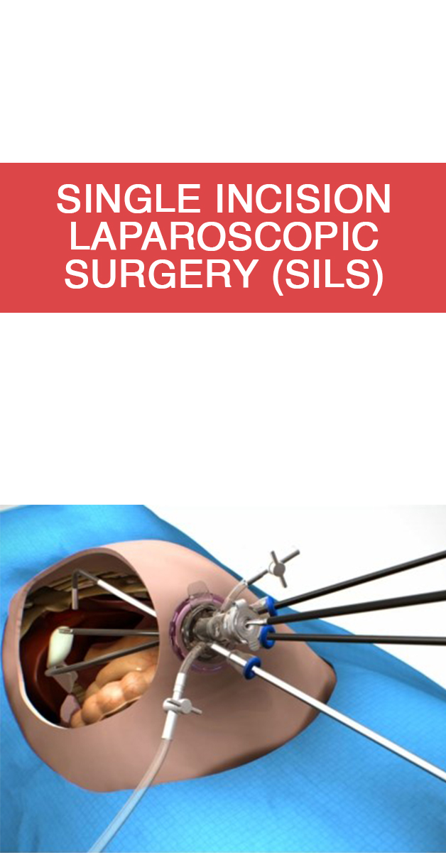 Single Incision Laparoscopic Surgeon in Mumbai
